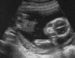Svalas bebis, berknad ankomst 9 sept 2002